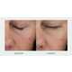 Micropolymer Facial Serums Image 2