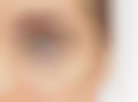 Bio-Sensing Contact Lens