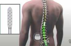 Spinal Injury Repair Implants