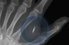 Tech-Controlling Implantable Microchips