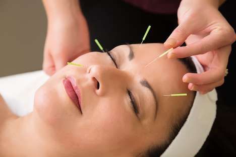 Facial Acupuncture Treatments
