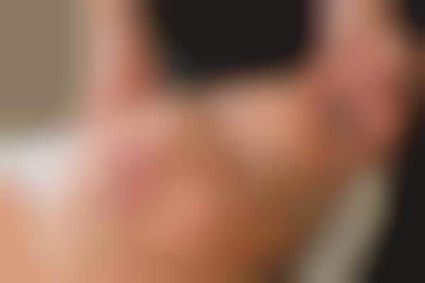 Facial Acupuncture Treatments