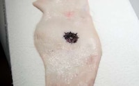 Health-Monitoring Tattoos Image 3