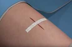 Non-Invasive Bandage Stitches