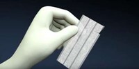 Non-Invasive Bandage Stitches Image 3