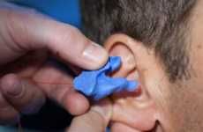 3D-Printed Hearing Aids