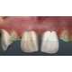 AR Dentistry Mirrors Image 4