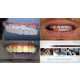 AR Dentistry Mirrors Image 6