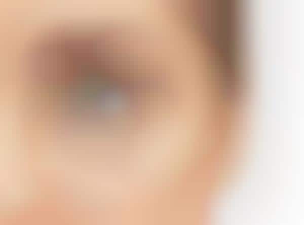 Bio-Sensing Contact Lenses
