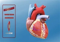 Personalized Heart Simulators Image 3