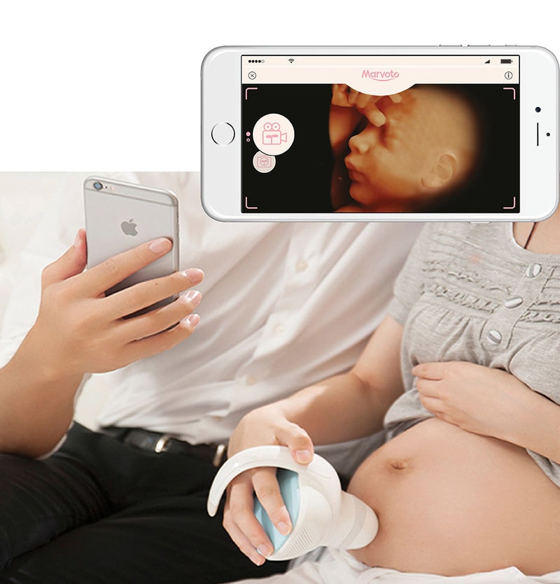 At-Home Echograph Cameras