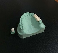 Rapidly 3D-Printed Dentures Image 2