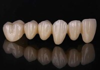 Rapidly 3D-Printed Dentures Image 3