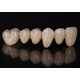 Rapidly 3D-Printed Dentures Image 3