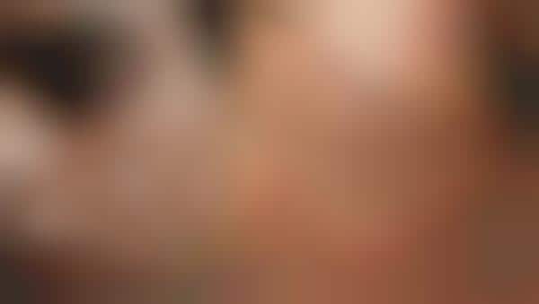 Acne-Normalizing Photography