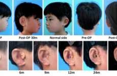 In Vitro Ear Regeneration