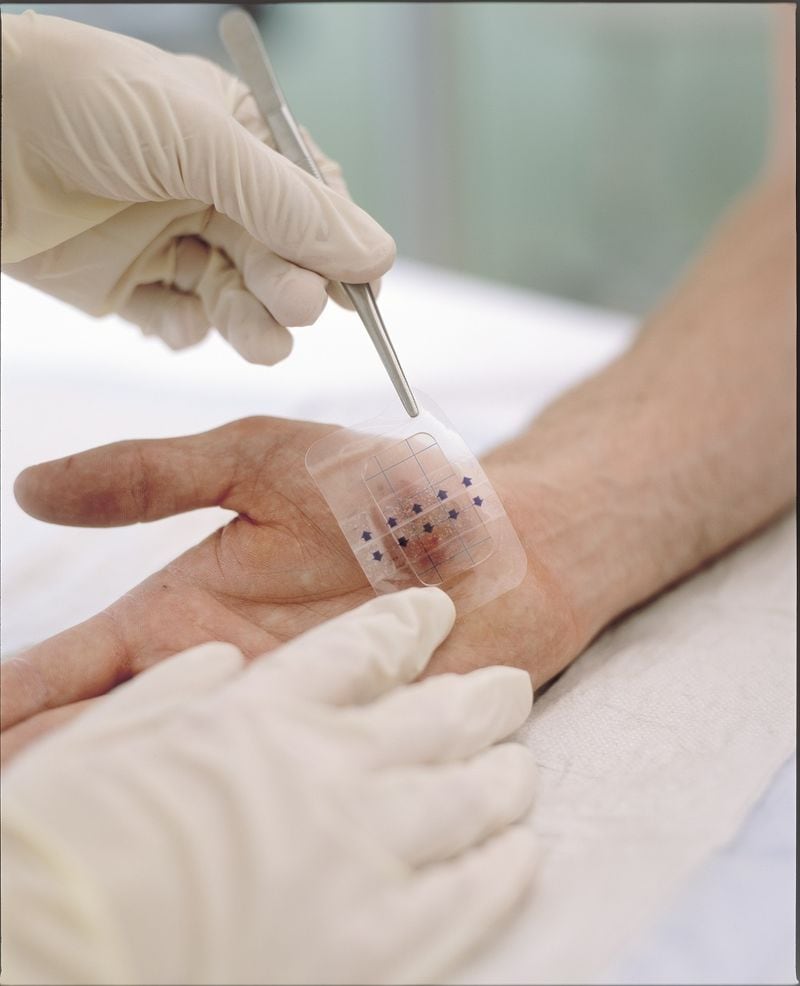 Bio-Printed Wound Dressings