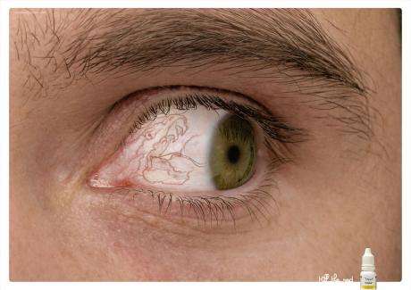 Bloodshot Ad Campaigns