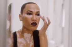 Vitiligo Model-Inclusive Beauty Campaigns