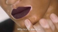 Vitiligo Model-Inclusive Beauty Campaigns Image 4
