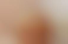 Supersized Breakfast Burgers