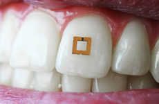 Bioresponsive Tooth Stickers