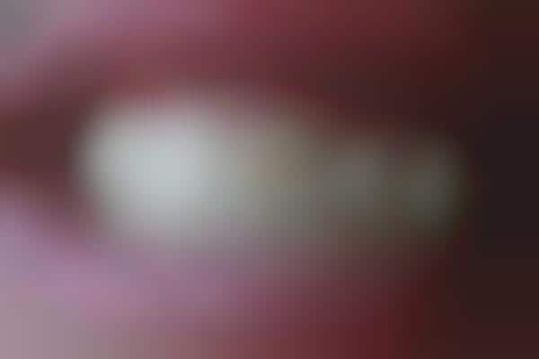 In-Mouth Tracking Wearables