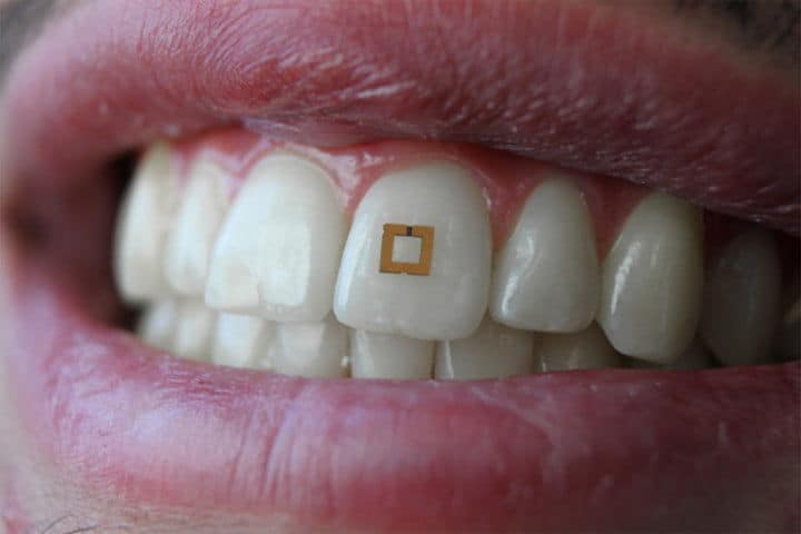 In-Mouth Tracking Wearables