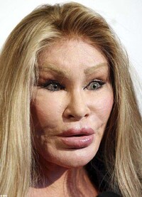 Feline-Inspired Plastic Surgery Horrors Image 2