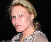 Feline-Inspired Plastic Surgery Horrors Image 3