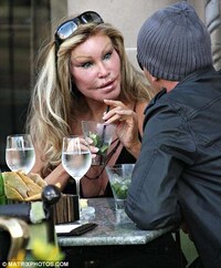 Feline-Inspired Plastic Surgery Horrors Image 4
