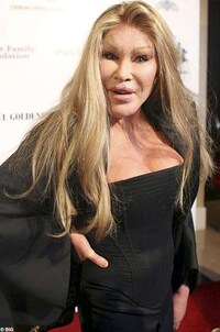 Feline-Inspired Plastic Surgery Horrors Image 5