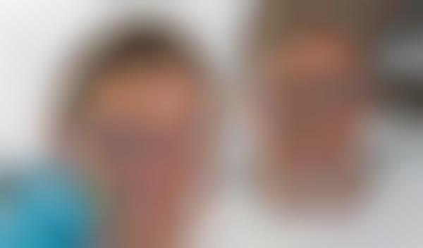 3D-Printed Human Corneas