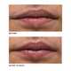 Vegan Lip-Plumping Treatments Image 4