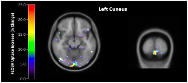 Neurotransmitter-Boosting Brain Apps
