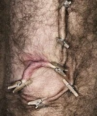 Pinched Flesh Alphabets Image 2