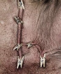 Pinched Flesh Alphabets Image 3