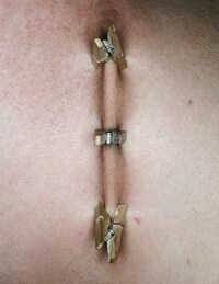 Pinched Flesh Alphabets Image 4