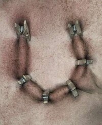 Pinched Flesh Alphabets Image 7