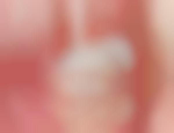 Sensitive Rose Gold Skincare