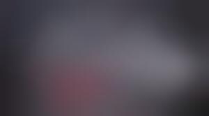 Banish Baldness With The HairMax Laser Comb