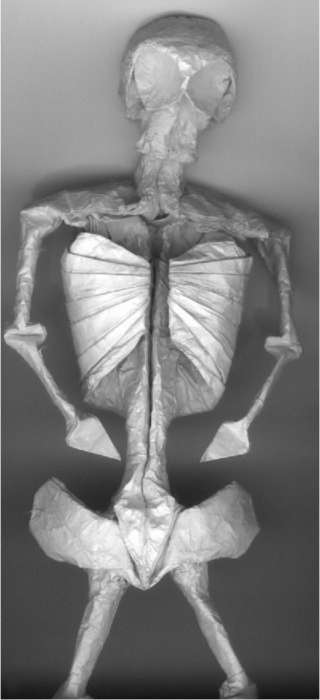 Anatomical Origami