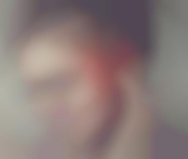 Unclogging Ear Tube Exercisers