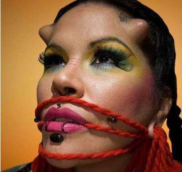 39 Freaky Implants & Transplants
