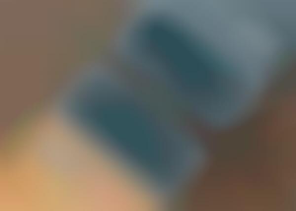 Component-Revealing Battery Packs