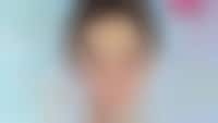 AI Skincare Diagnostic Tools Image 1