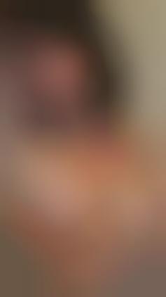 Unbanning Breast Photos