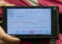 Needle-Free Blood Tests Image 2