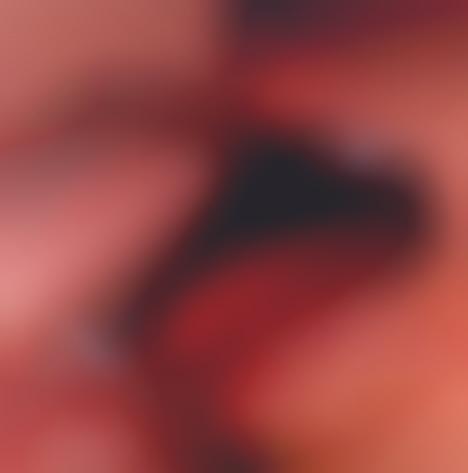 Eye Licking