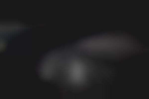 AI-Integrated Hearing Aids